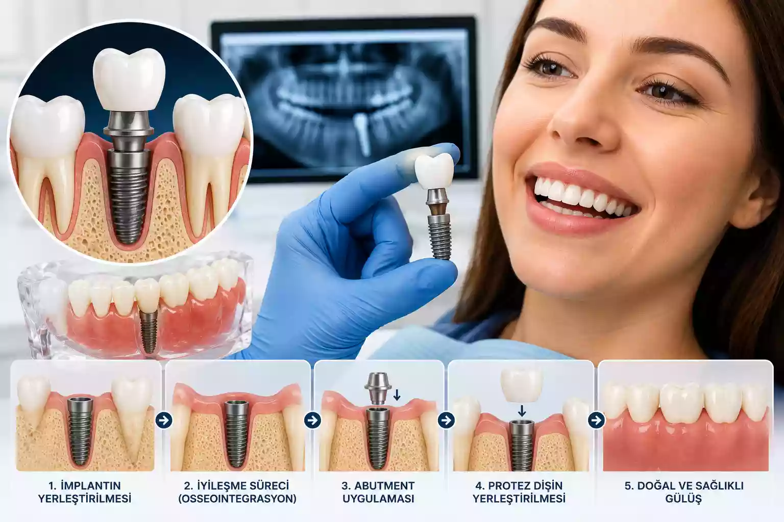 Diş Hekimi Dentist Müjde Alev Kumbaracı Milas Muğla