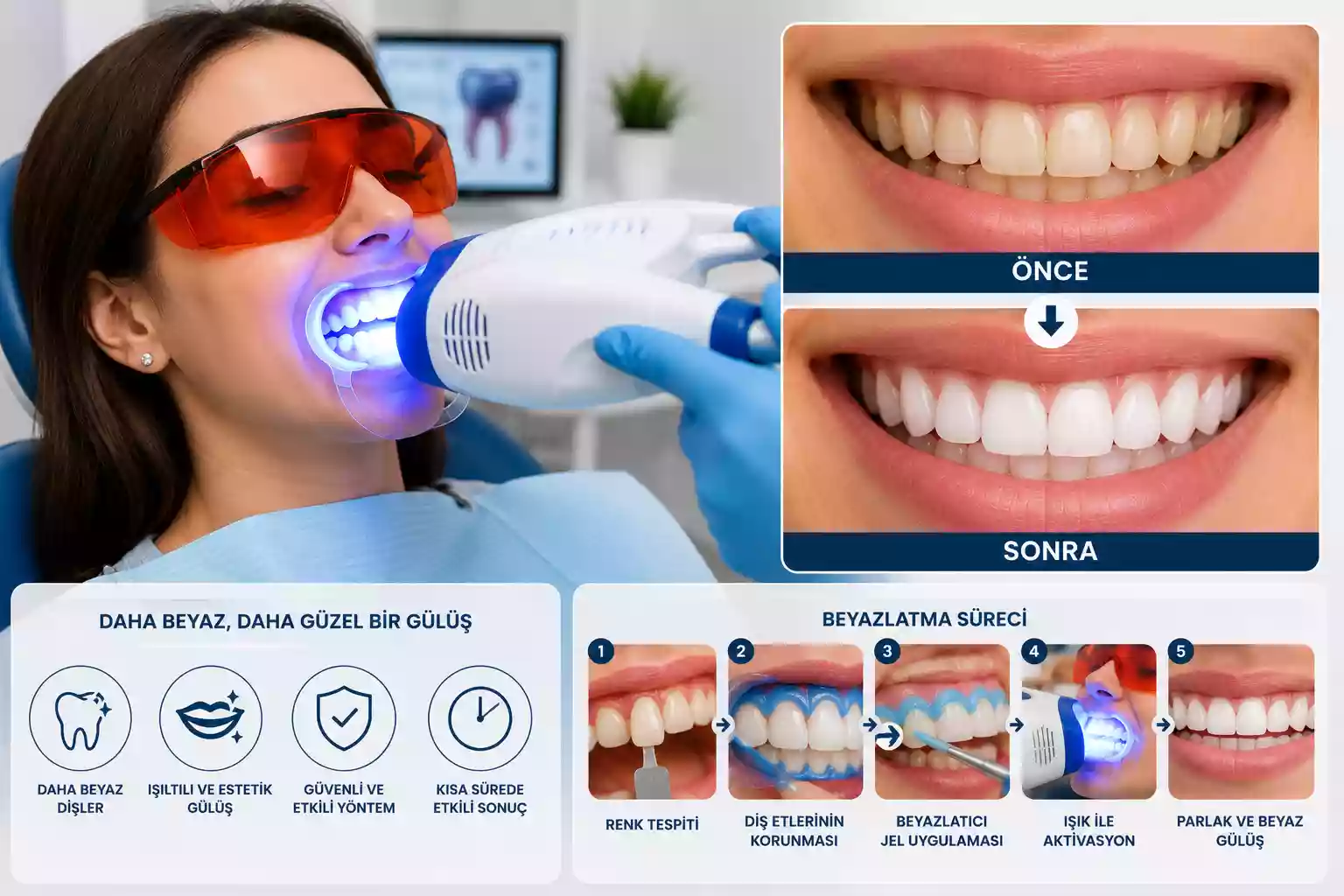 Milas Teeth Whitening